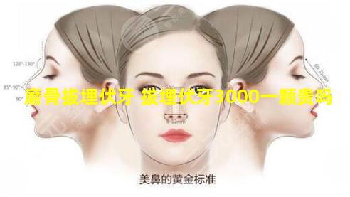 磨骨拔埋伏牙 拔埋伏牙3000一颗贵吗